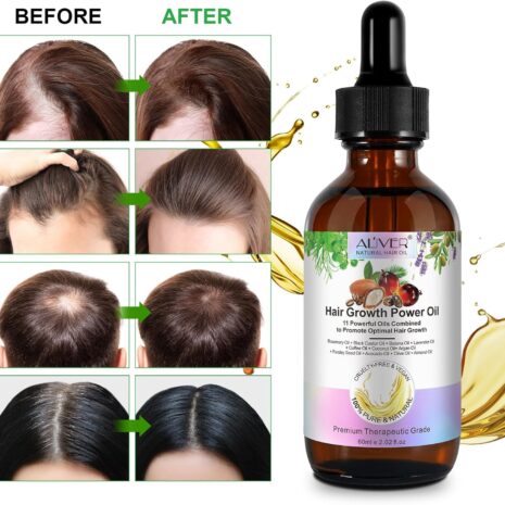 67cd5fb80b1c6ab1ffcb535b8887055c90af0aa206928493909b2.jpg 67cd5fb80b1c6ab1ffcb535b8887055c90af0aa206928493909b2.jpg